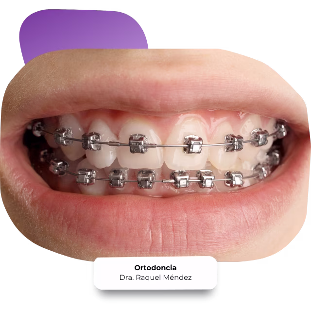 Diagnóstico ortodóntico completo en Nezahualcóyotl con cefalometría