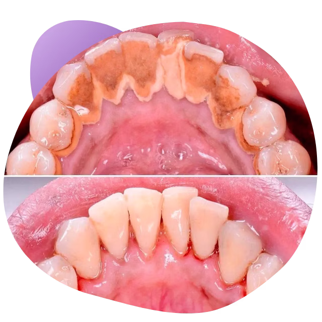 Evaluación dental completa en Nezahualcóyotl con Dra. Raquel Méndez