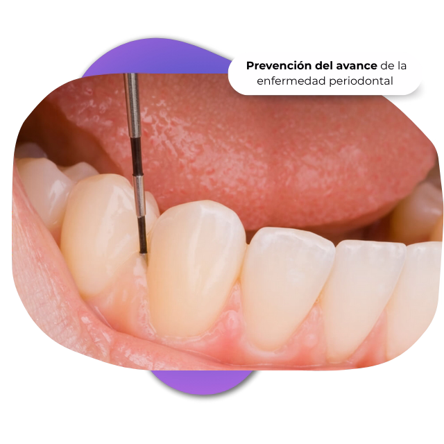 Especialista en periodoncia dental Nezahualcóyotl Dra. Raquel Méndez