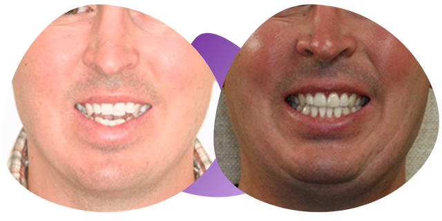 Testimonio de Alfredo de la Ortodoncista en Nezahualcóyotl Dra. Raquel Méndez