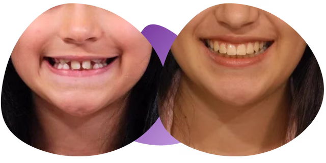 Testimonio de Andrea de la Ortodoncista en Nezahualcóyotl Dra. Raquel Méndez