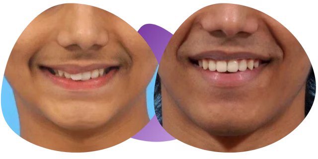 Testimonio de Matías de la Ortodoncista en Nezahualcóyotl Dra. Raquel Méndez