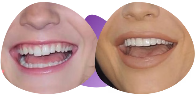 Testimonio de Olaia de la Ortodoncista en Nezahualcóyotl Dra. Raquel Méndez