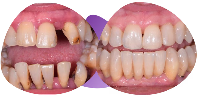 Testimonios de periodoncia dental Nezahualcóyotl de Jorge