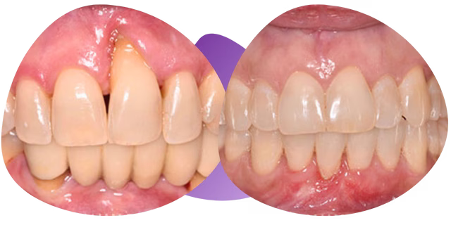 Testimonios de periodoncia dental Nezahualcóyotl de María