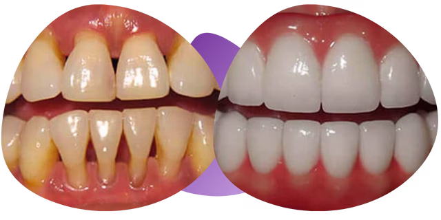 Testimonios de periodoncia dental Nezahualcóyotl de Pedro