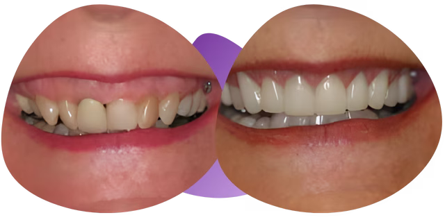 Testimonios de periodoncia dental Nezahualcóyotl de Sofía