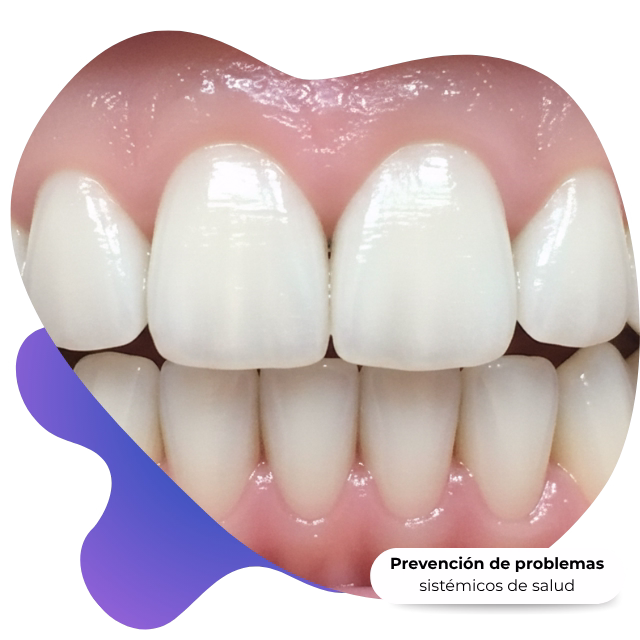Evaluación periodontal completa en Nezahualcóyotl